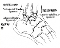  “拗柴”怎處理？